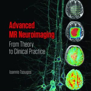 Advanced MR Neuroimaging: From Theory to Clinical Practice