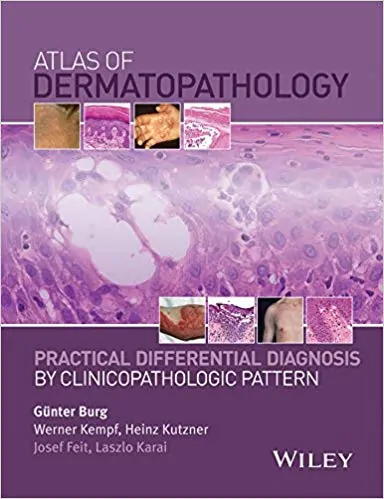 Atlas of Dermatopathology: Practical Differential Diagnosis by Clinicopathologic Pattern - eBook