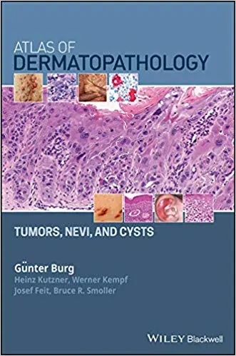 Atlas of Dermatopathology: Tumors, Nevi, and Cysts - eBook