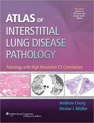 Atlas of Interstitial Lung Disease Pathology: Pathology with High Resolution CT Correlations - eBook