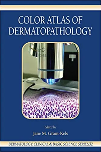 Color Atlas of Dermatopathology (Dermatology: Clinical & Basic Science Book 32) - eBook