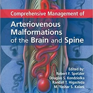 Comprehensive Management of Arteriovenous Malformations of the Brain and Spine - eBook