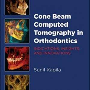Cone Beam Computed Tomography in Orthodontics: Indications, Insights, and Innovations - eBook