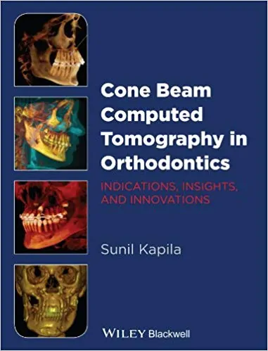 Cone Beam Computed Tomography in Orthodontics: Indications, Insights, and Innovations - eBook