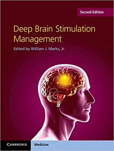 Deep Brain Stimulation Management (2nd Edition) - eBook