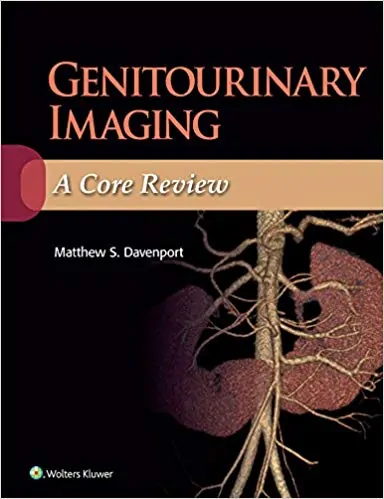 Genitourinary Imaging: A Core Review - eBook