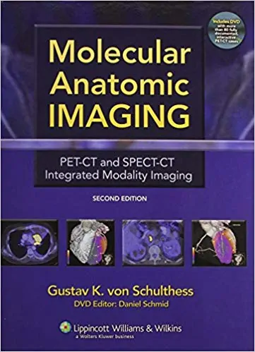 Molecular Anatomic Imaging: PET-CT and SPECT-CT Integrated Modality Imaging (2nd Edition) - eBook