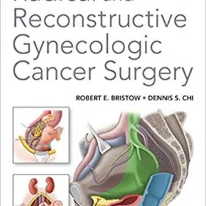 Radical and Reconstructive Gynecologic Cancer Surgery - eBook