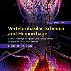 Vertebrobasilar Ischemia and Hemorrhage: Clinical Findings, Diagnosis and Management of Posterior Circulation Disease (2nd Edition) - eBook