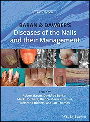 Baran and Dawber's Diseases of the Nails and their Management (5th Edition) - eBook