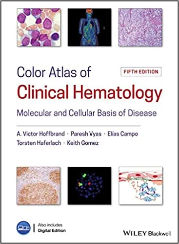 Color Atlas of Clinical Hematology: Molecular and Cellular Basis of Disease (5th Edition) - eBook