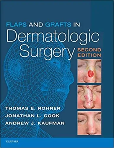 Flaps and Grafts in Dermatologic Surgery (2nd Edition) - eBook