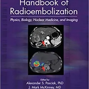 Handbook of Radioembolization: Physics, Biology, Nuclear Medicine, and Imaging - eBook