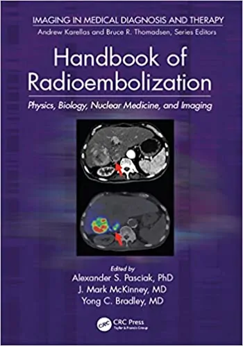 Handbook of Radioembolization: Physics, Biology, Nuclear Medicine, and Imaging - eBook