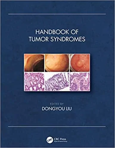 Handbook of Tumor Syndromes - eBook