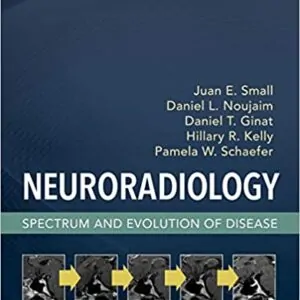 Neuroradiology: Spectrum and Evolution of Disease - eBook