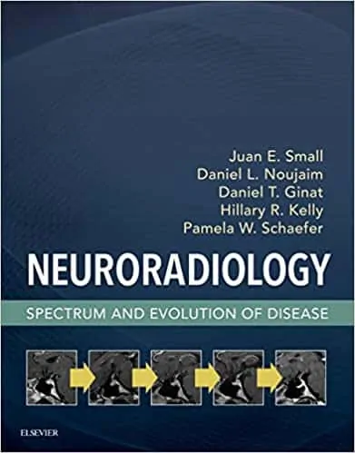 Neuroradiology: Spectrum and Evolution of Disease - eBook