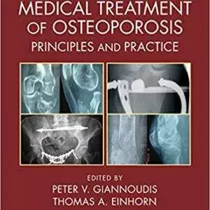 Surgical and Medical Treatment of Osteoporosis: Principles and Practice - eBook