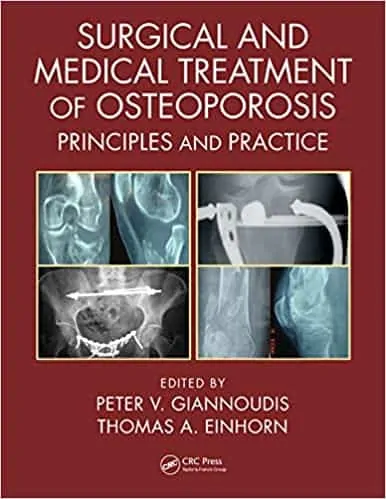 Surgical and Medical Treatment of Osteoporosis: Principles and Practice - eBook