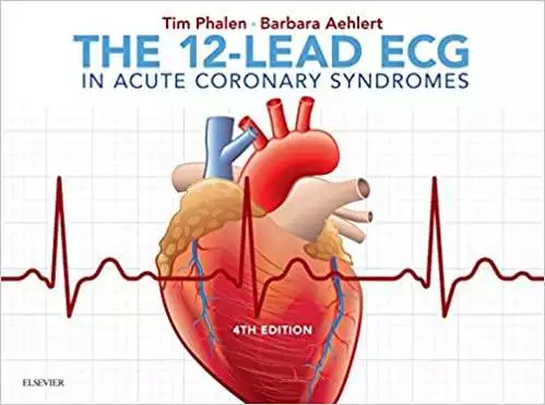 The 12-Lead ECG in Acute Coronary Syndromes (4th Edition) - eBook