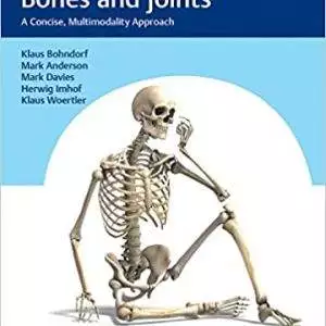 Imaging of Bones and Joints: A Concise, Multimodality Approach - eBook