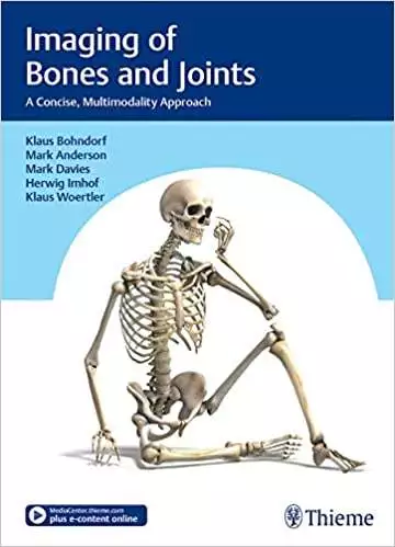 Imaging of Bones and Joints: A Concise, Multimodality Approach - eBook