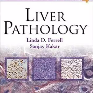 Liver Pathology (Consultant Pathology Book 4) - eBook