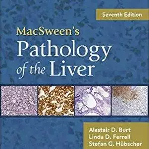 MacSween's Pathology of the Liver (7th Edition) - eBook