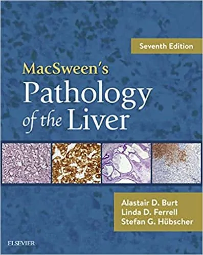 MacSween's Pathology of the Liver (7th Edition) - eBook