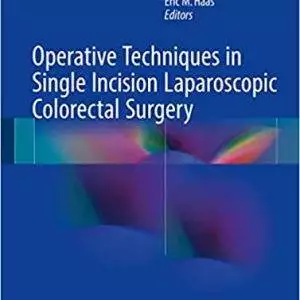 Operative Techniques in Single Incision Laparoscopic Colorectal Surgery - eBook