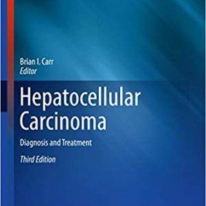 Hepatocellular Carcinoma - Diagnosis and Treatment (3rd Edition) - PDF