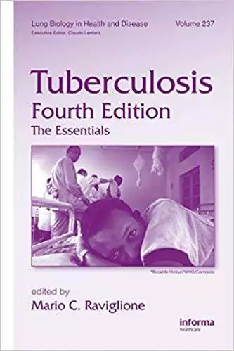 Tuberculosis: The Essentials (4th Edition)- eBook