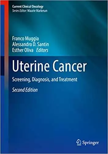 Uterine Cancer: Screening, Diagnosis, and Treatment (2nd Edition) - eBook