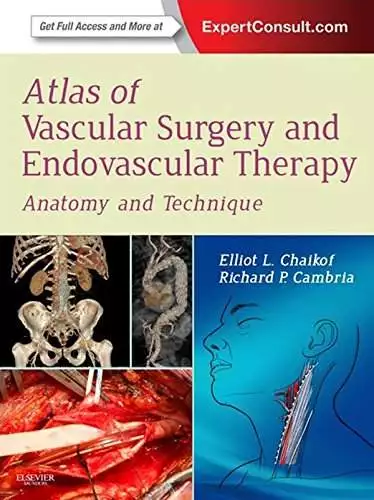 Atlas of Vascular Surgery and Endovascular Therapy: Anatomy and Technique - eBook