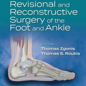 Revisional and Reconstructive Surgery of the Foot and Ankle - ePub