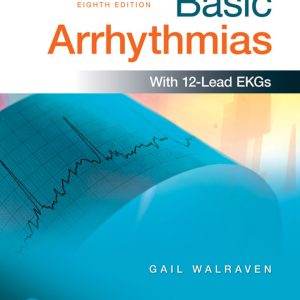 Basic Arrhythmias (8th Edition) - eBook