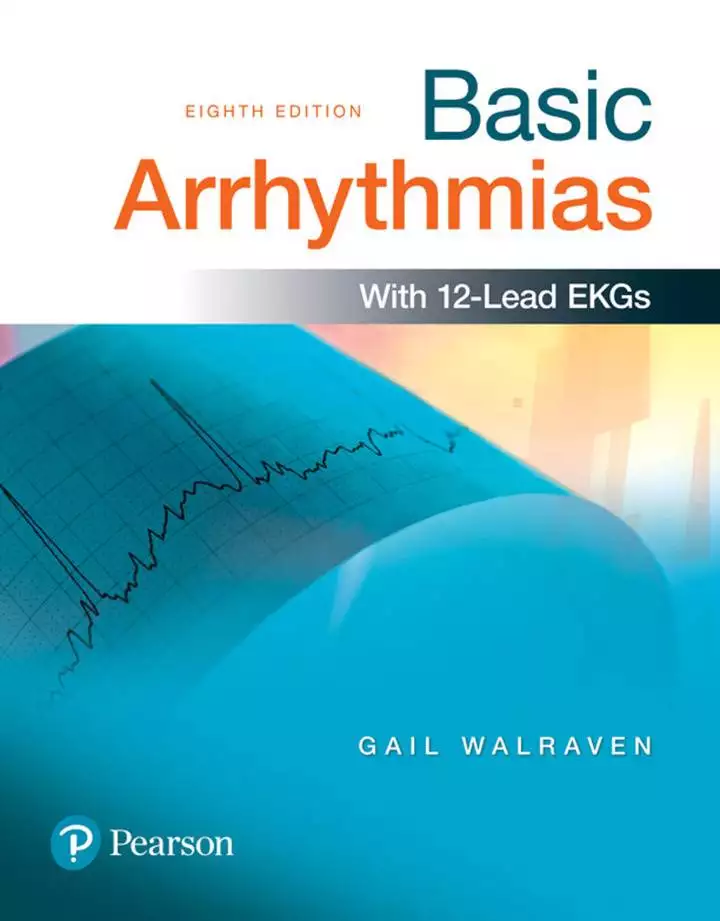 Basic Arrhythmias (8th Edition) - eBook