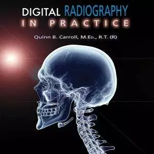 Digital Radiography in Practice (2nd Edition) - eBook